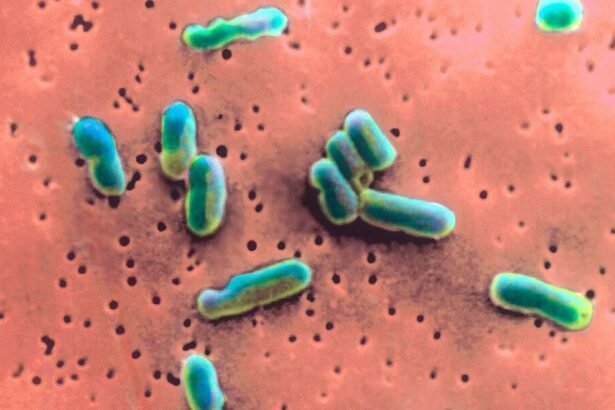 Vibrio vulnificus