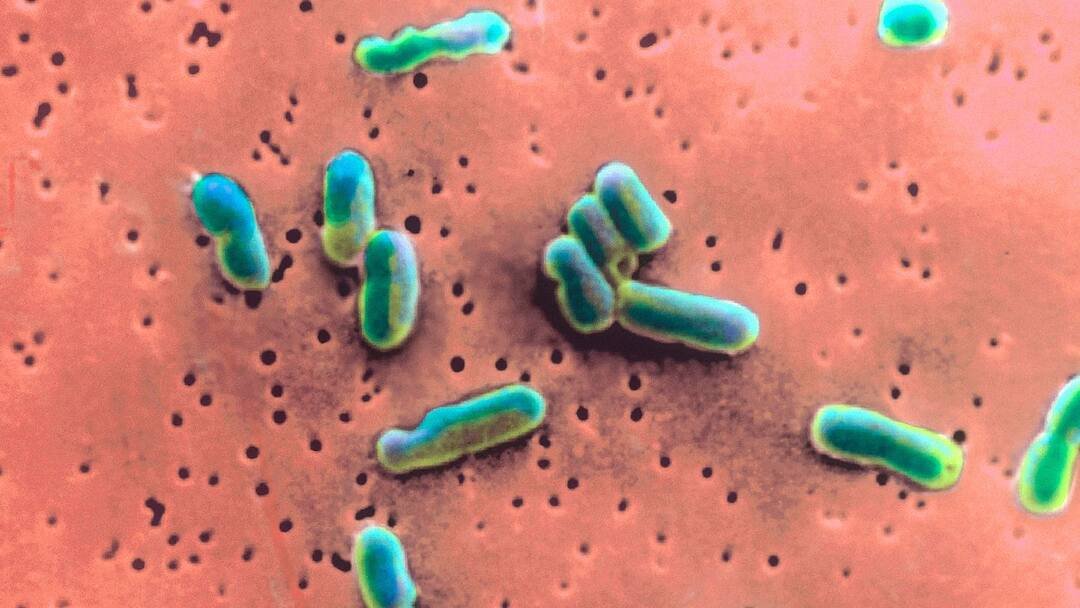 Vibrio vulnificus